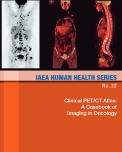 PET/CT-Atlas, publiziert von IAEA und Prof. Dr. Freudenberg